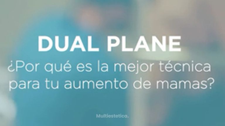 Técnica Dual Plane  -Aumento de Pecho