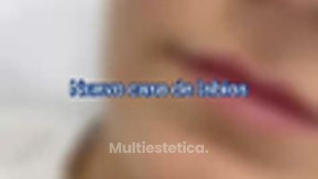 Clínica Carlos Gómez - Labios