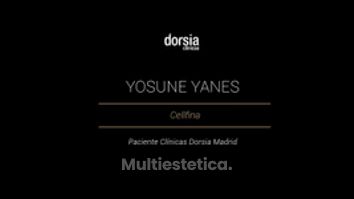 Yosune Yanes - Cellfina