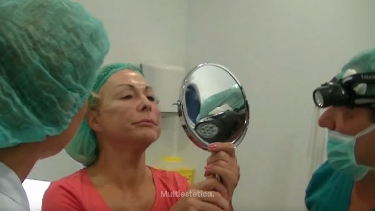 Los hilos aptos o hilos rusos