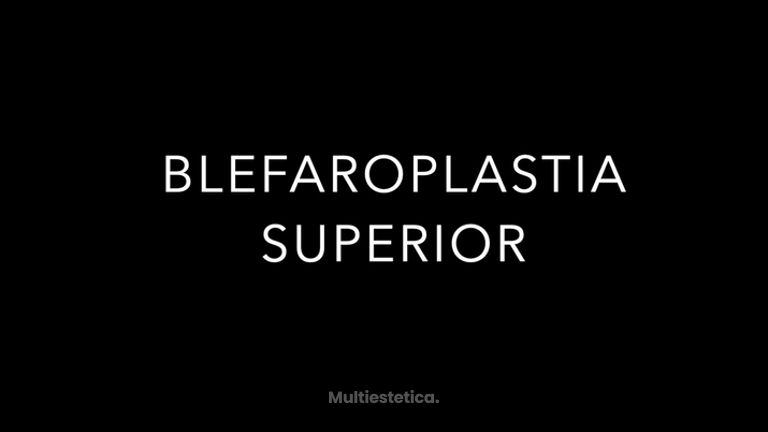 Blefaroplastia superior - Dr. Jiménez Ortiz