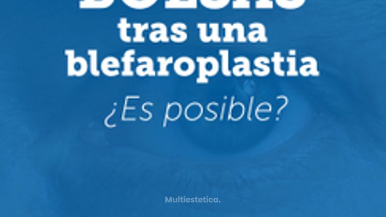 Bolsas en los ojos después de una blefaroplastia inferior. Explicación Dra. Madrigal