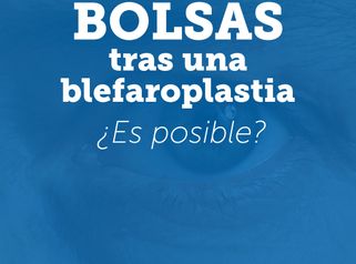 Bolsas en los ojos después de una blefaroplastia inferior. Explicación Dra. Madrigal