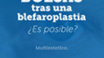 Bolsas en los ojos después de una blefaroplastia inferior. Explicación Dra. Madrigal