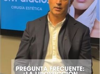 Liposucción: zonas, anestesia y recuperación.