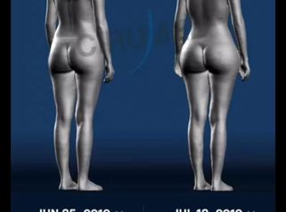 Bodyscanning nueva tecnología para analizar antes y después