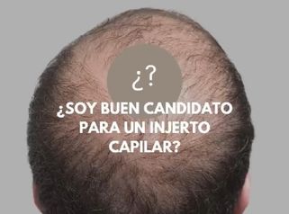 👨_⚕️ ¿Soy buen candidato para un injerto capilar?