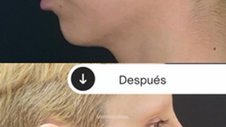 La armonización facial busca equilibrar tus facciones y resaltar tu belleza natural