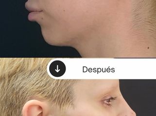 La armonización facial busca equilibrar tus facciones y resaltar tu belleza natural