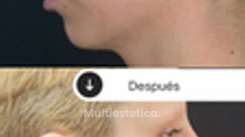 La armonización facial busca equilibrar tus facciones y resaltar tu belleza natural