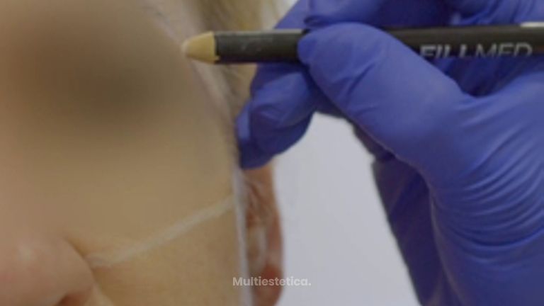 Armonización facial - Clínica de la Cuesta CDC