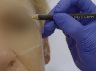 Armonización facial - Clínica de la Cuesta CDC