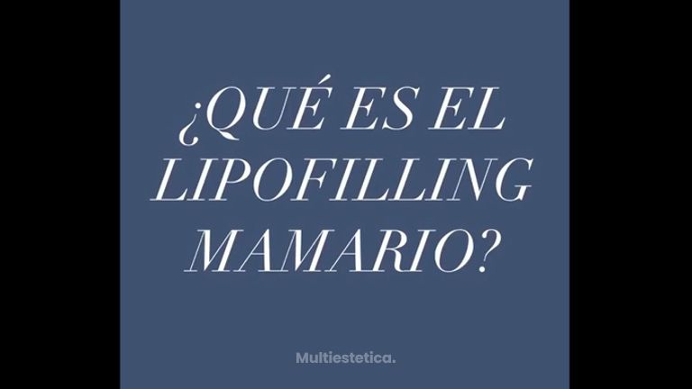 Lipofilling mamario ¿qué es?