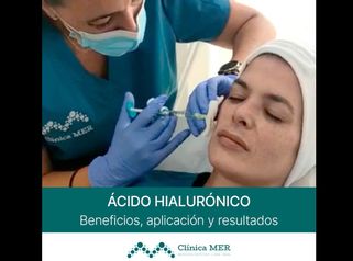 Ácido hialurónico - Clínica MER