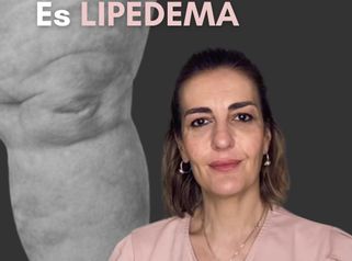Lipedema