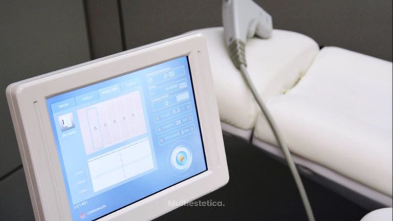 Ultrasonido focalizado de alta intensidadad