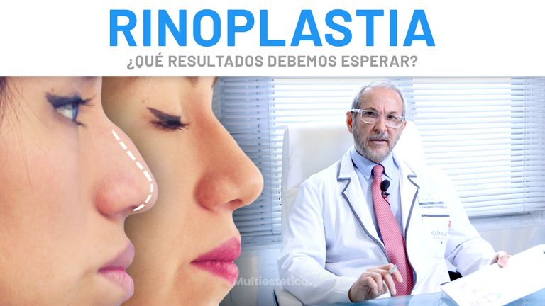 Rinoplastia – Nuestros Doctores
