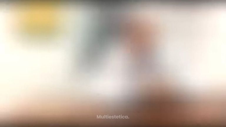 Rinoplastia