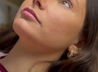 Lemon aumento de labios