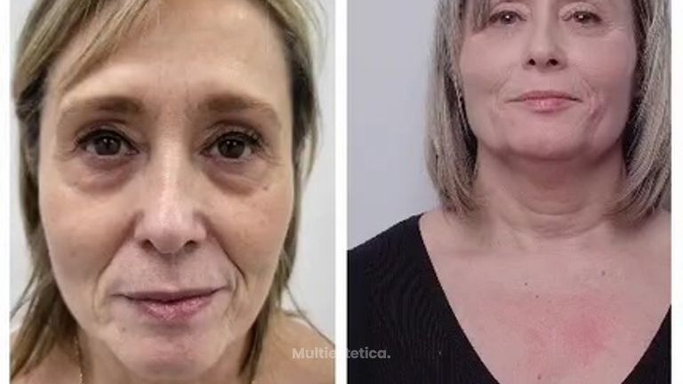 Clínica Carlos Gómez - Rejuvenecimiento