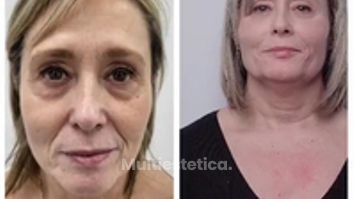 Clínica Carlos Gómez - Rejuvenecimiento