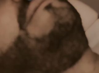 ✨ Aumento de labios masculino con ácido hialurónico ✨