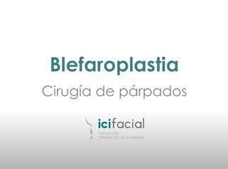 Blefaroplastia o cirugía de párpados por Dr Macia Colón de Icifacial