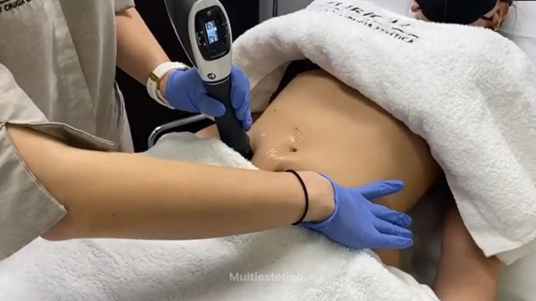 Remodelar el cuerpo sin cirugía - Clínicas Zurich