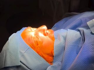 Rinoplastia - Clinica Silvia Roson