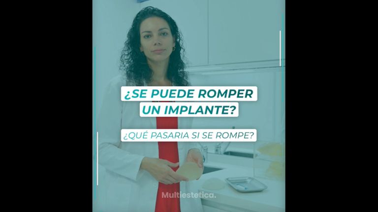 ¿Se puede romper un implante? - Dra. Estefanía Poza Guedes