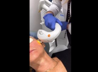 Rejuvenecimiento facial - Cenydiet