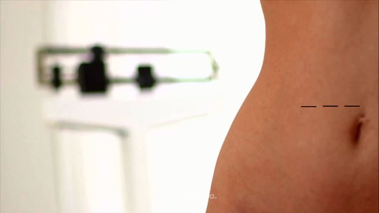 Acabar con pequeños cúmulos de grasa rebeldes en el abdomen