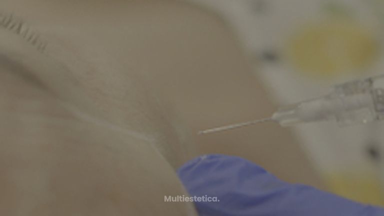 Ácido Hialurónico - Clínica de la Cuesta CDC