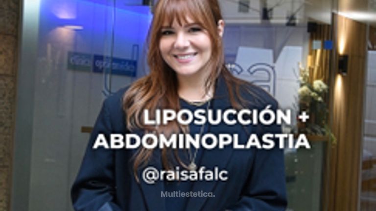 Abdominoplastia - Clínica Opción Médica