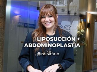 Abdominoplastia - Clínica Opción Médica