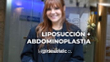 Abdominoplastia - Clínica Opción Médica