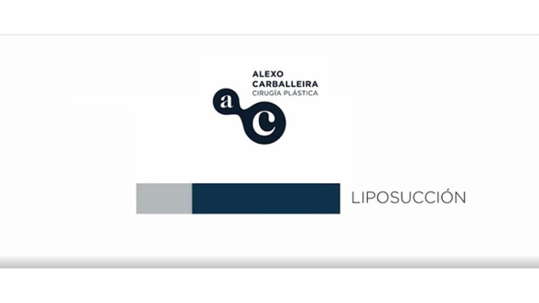 Liposucción por Alexo Carballeira