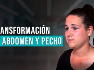 Transformación Total de Carolina： Cirugía de Abdominoplastia y Aumento de Pecho