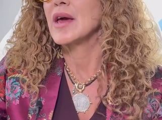 Nieves logró armonizar su rostro✨Gracias al tratamiento especializado, pudo recuperar la confianza