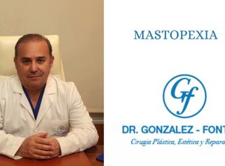 Mastopexia - Dr. Gonzalez-Fontana