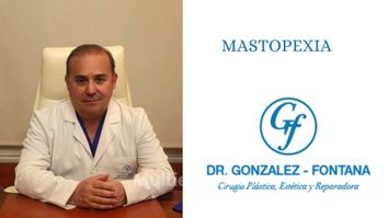 Mastopexia - Dr. Gonzalez-Fontana