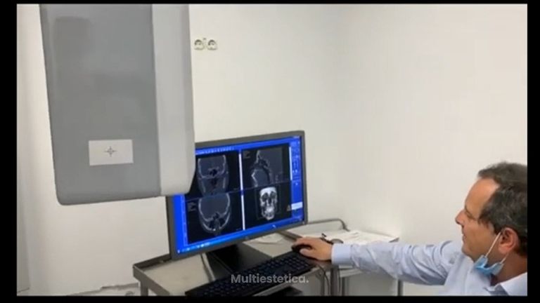 Cirugía ortognática - Dr. Antonio Vázquez Rodríguez