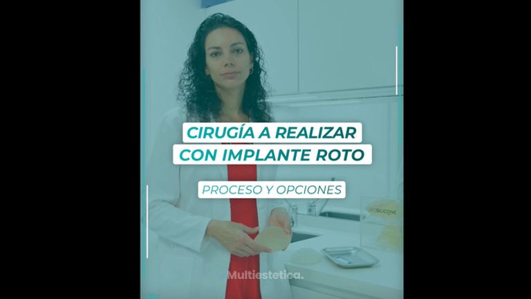 Cirugía a realizar con implante roto - Dra. Estefanía Poza Guedes