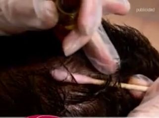 Frena la caída del cabello