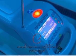 Medicina Estética Coimbra - Liposucción sin cirugía