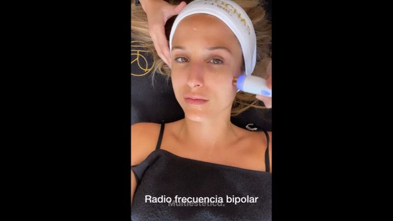 Rejuvenecimiento facial - Les Rochas Clinic