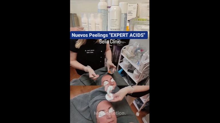 Peeling - Belia Clinic