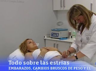 Novedoso tratamiento estrías INSTIMED