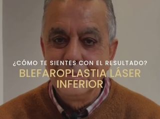 Blefaroplastia Láser Inferior