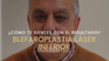 Blefaroplastia Láser Inferior